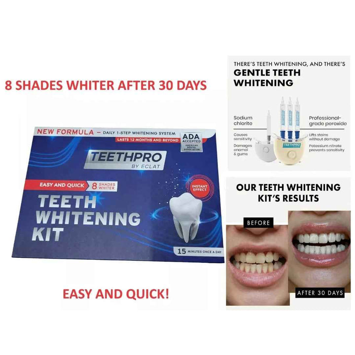 Teeth Whitening Kit